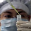 In China, a day number of cases of influenza H7N9 has increased to 87 people