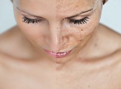 Как избавиться от раздражения кожи