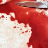Многочисленные ножевые ранения получила супружеская пара в Уссурийске в результате разбойного нападения