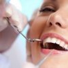 Все, что необходимо знать о протезировании зубов